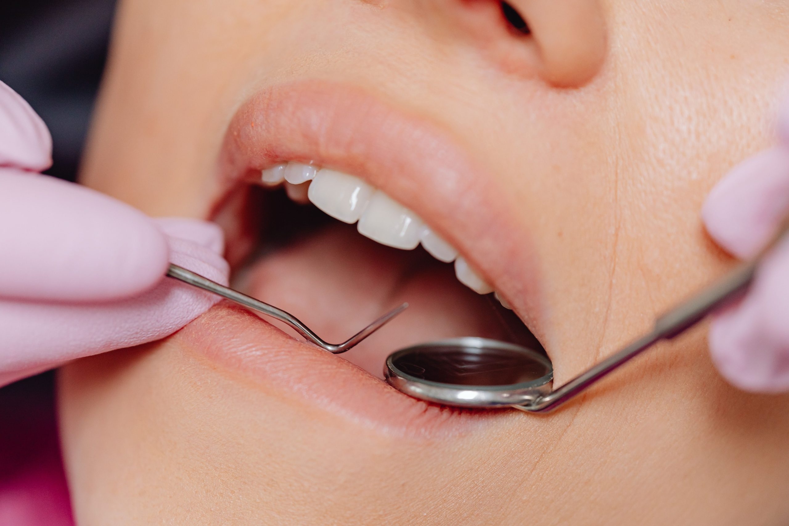 Gums and dentist check-up