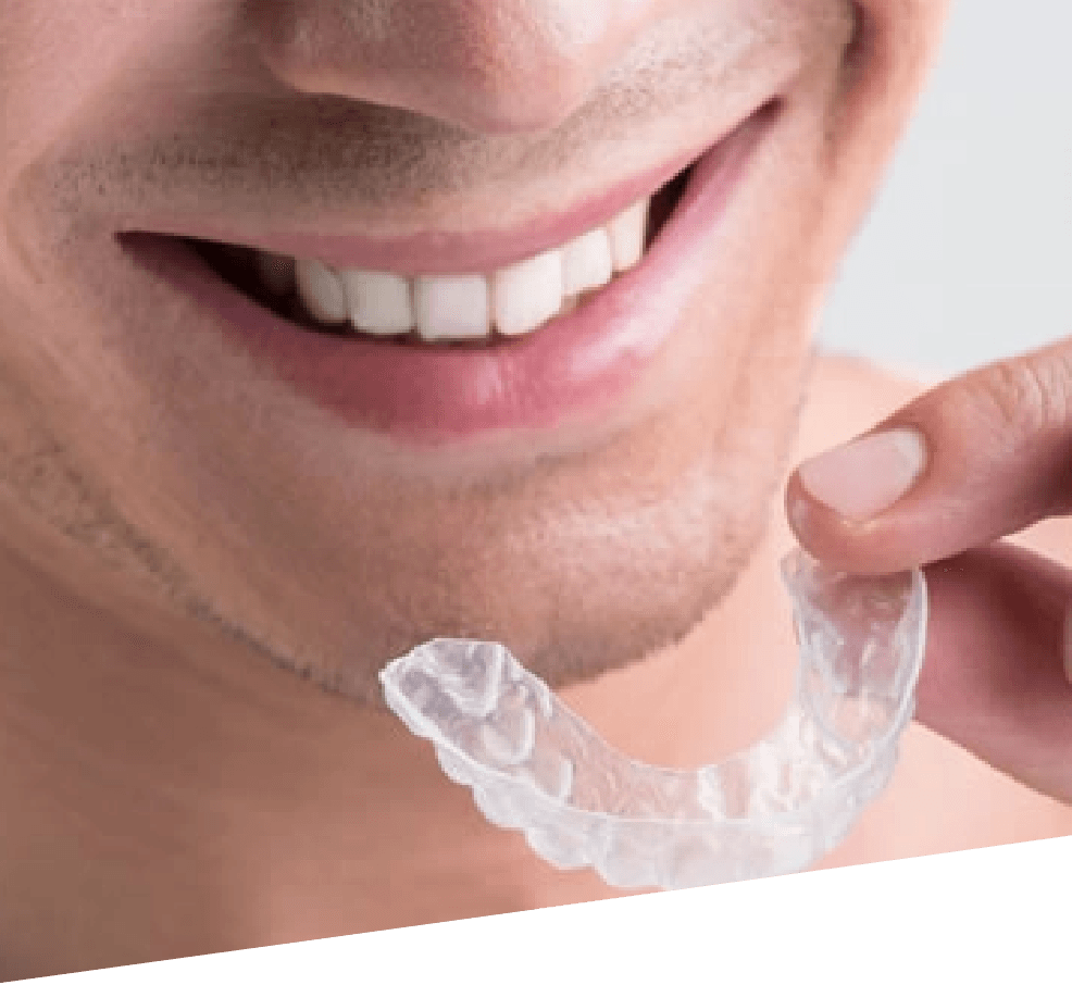 Man smiling and holding the Clear Aligners to his mouth